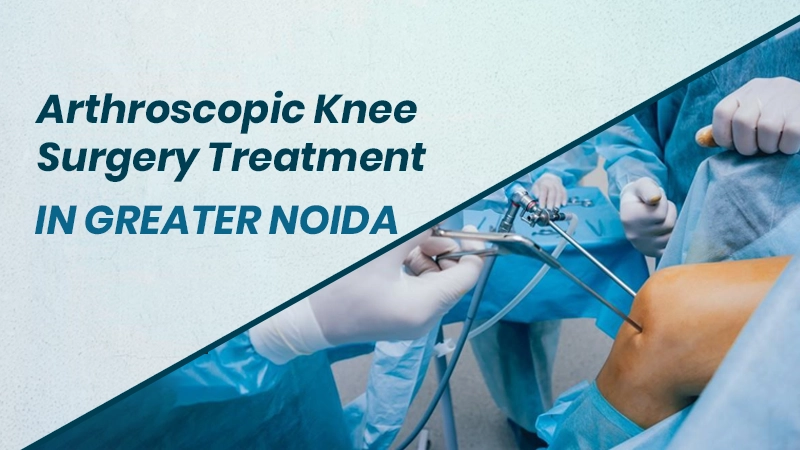 Arthroscopic Knee Surgery Treatment in Greater Noida Service